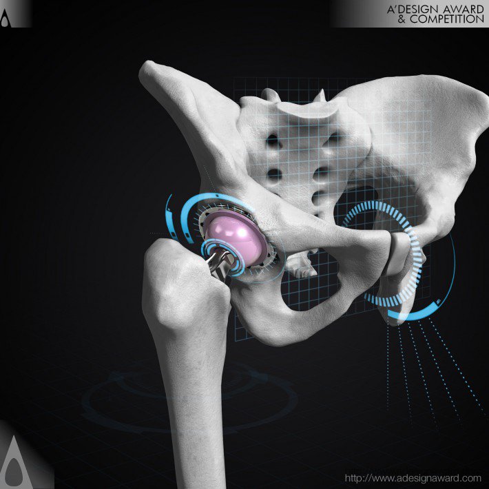 ops™-by-optimized-ortho-and-corin-group-1