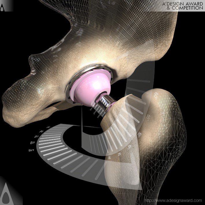 ops™-by-optimized-ortho-and-corin-group